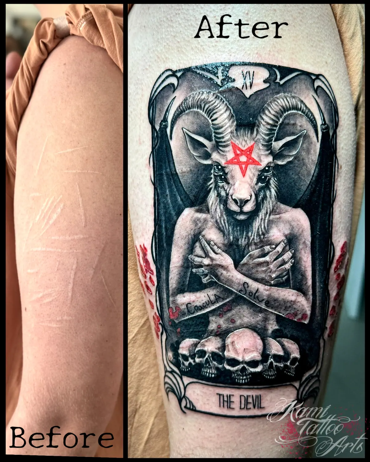 Scars Coverup Tattoo Devil Taro Card Tarot Magic Solve Coagula Baphomet Satan Skulls Dark Art Pentagram Goat